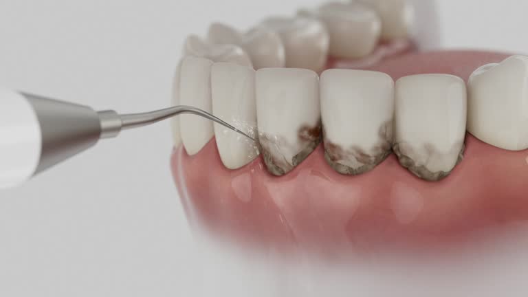 Reliable Dental Implants contractor in Kusilvak Census Area County, AK by Dentist Open Now